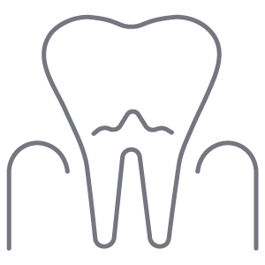 Prodontos Icon Endodontie (Wurzelkanalbehandlung)