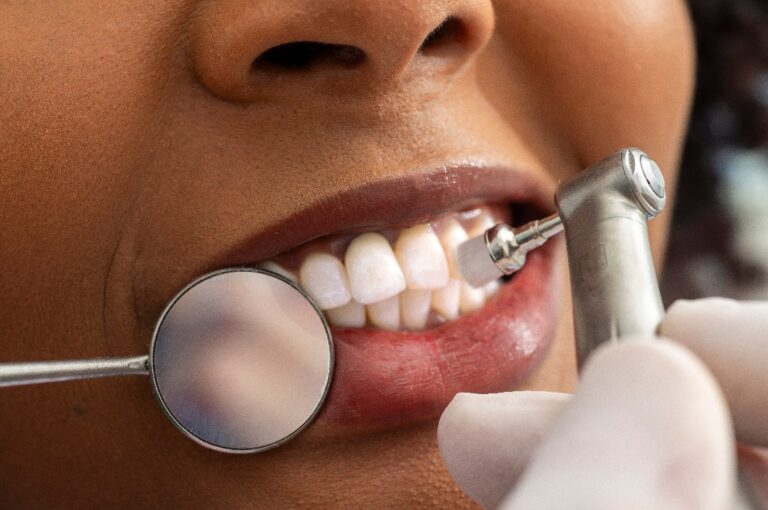 Zahnarzt poliert die Zähne eines Patienten in einer Zahnklinik.